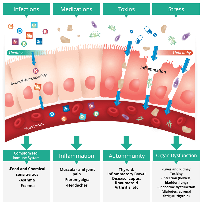 photo of Leaky Gut Syndrome Functional Medicine in San Diego